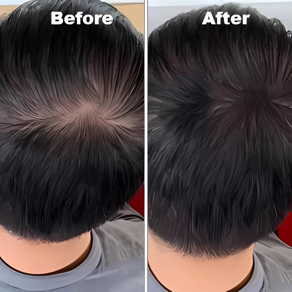 c4075457-c517-48b2-b09f-733a000b6322.__CR0,0,300,300_PT0_SX300_V1___