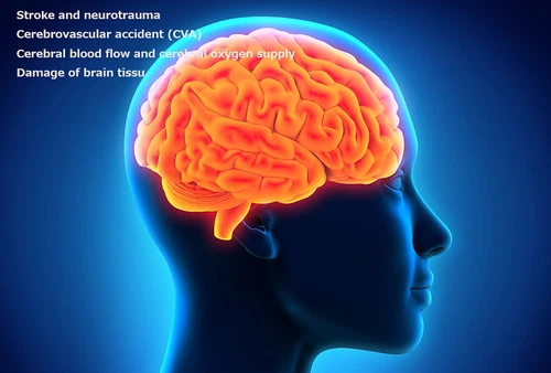 blog-brainjpg blog-brainjpg