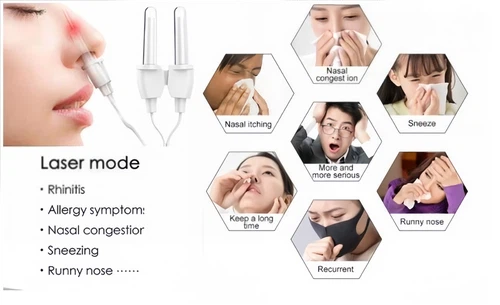 laser treatment for tinnitus laser treatment for tinnitus