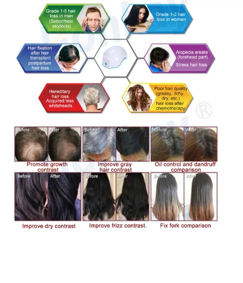 red light hair helmet red light hair helmet