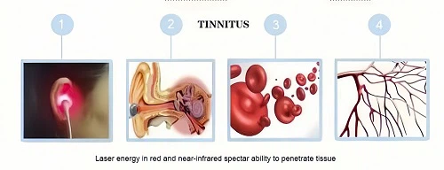 BQ06 16001 BQ06 16001