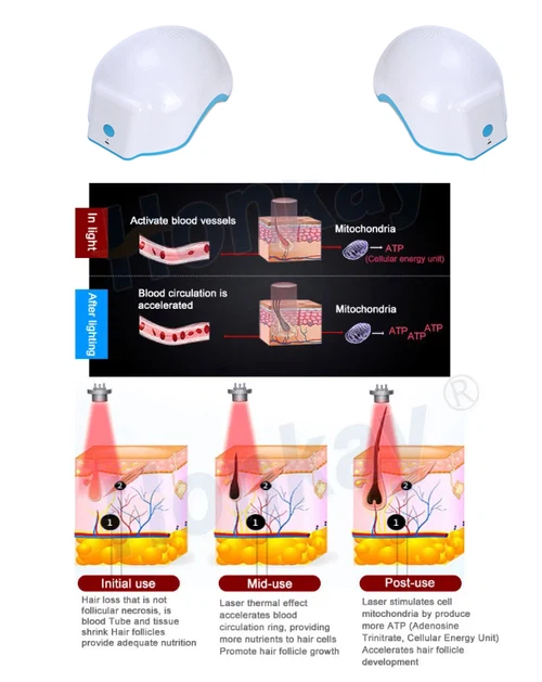 red light helmet hair growth red light helmet hair growth