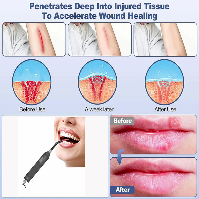 81yuBpIY2fLACSL1500 81yuBpIY2fLACSL1500