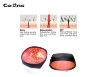 لیزر بالوں کی بحالی کی ٹوپی